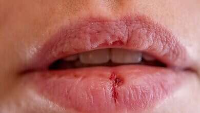 صورة تعبيرية (مواقع)